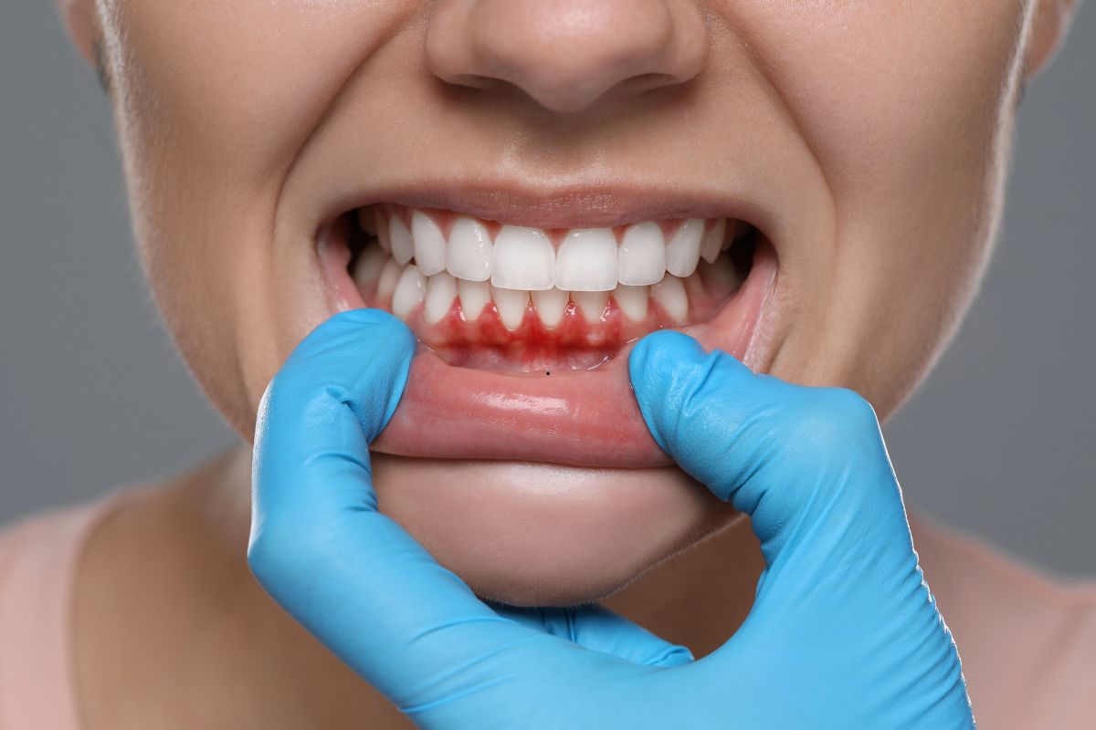 dentist in silver spring